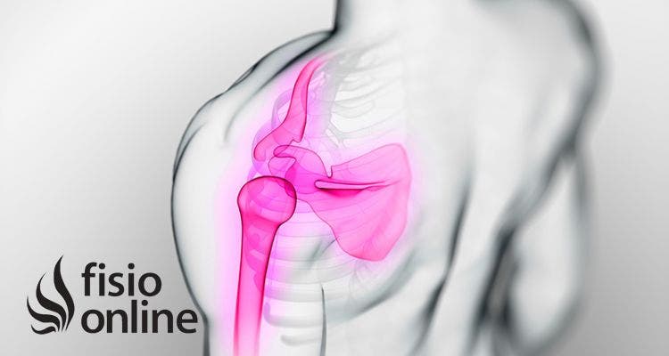 Como recuperarse de una fractura de femur